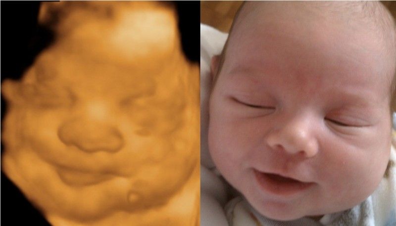 LifeNewsHQ's tweet photo. Leading OBGYN Confirms: An Unborn Baby is a Human Being From the Moment of Conception https://t.co/eZEOeaIuC1 https://t.co/V2zLQKoHfW