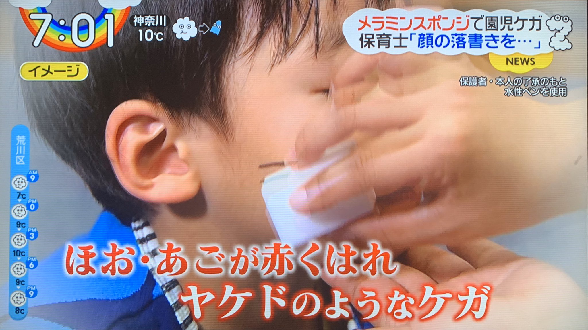 Toyo 今テレビでやってたメラミンスポンジで顔を擦るって言うのやった事あるけど マジで皮膚が荒れてカサブタになった事があるから絶対にやめるんだぞ メラミンスポンジで綺麗になる気がするのは気がするだけだぞ T Co Valpyjqcjr Twitter