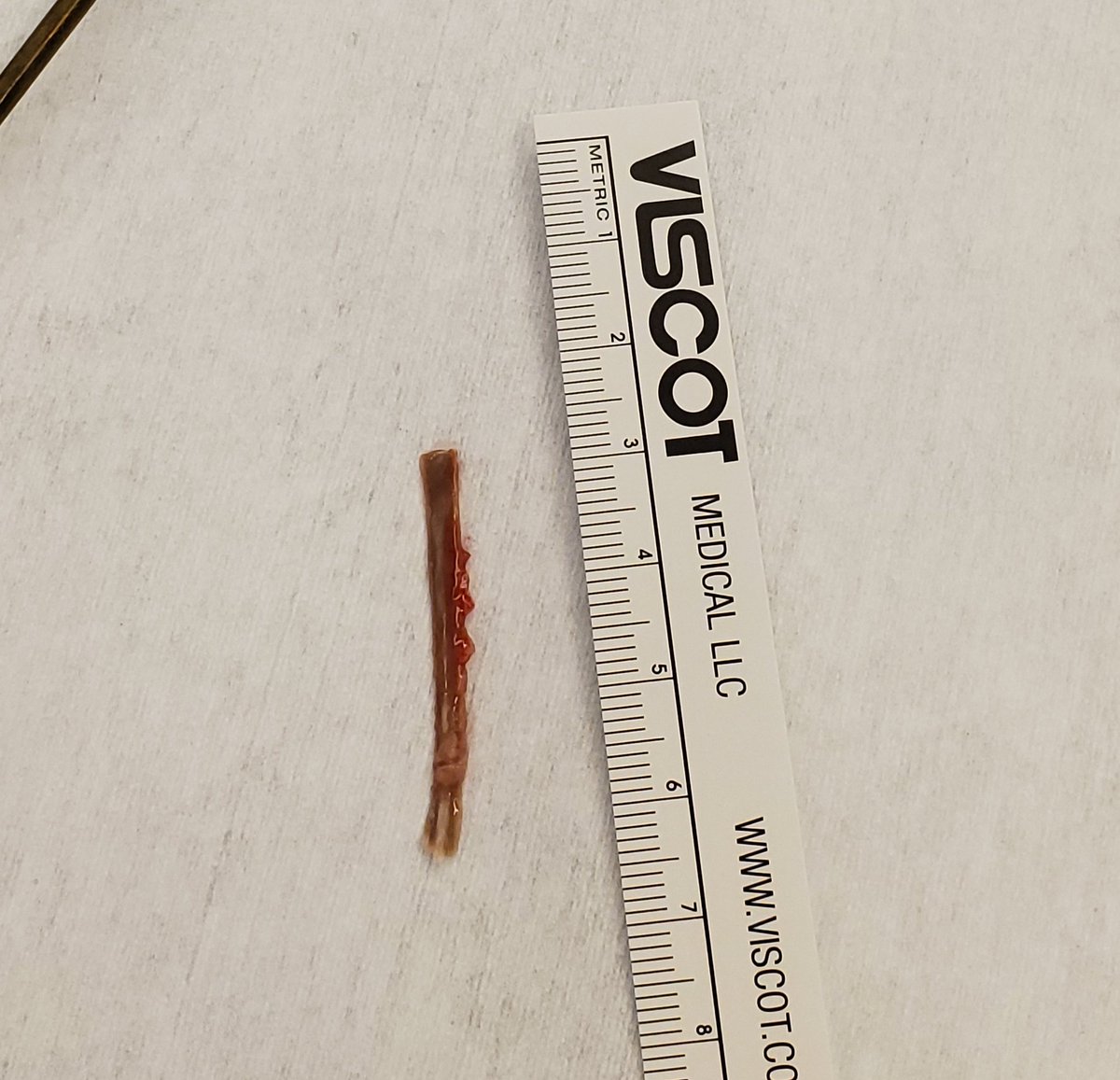 BianaLanson's tweet photo. Never a dull night on call for @stamfordENT on Christmas! Chicken bone removed from the pharynx @StamfordHosp OR. Patient doing well! Many relieved smiles from the family. 😌 https://t.co/xkFuq11emt