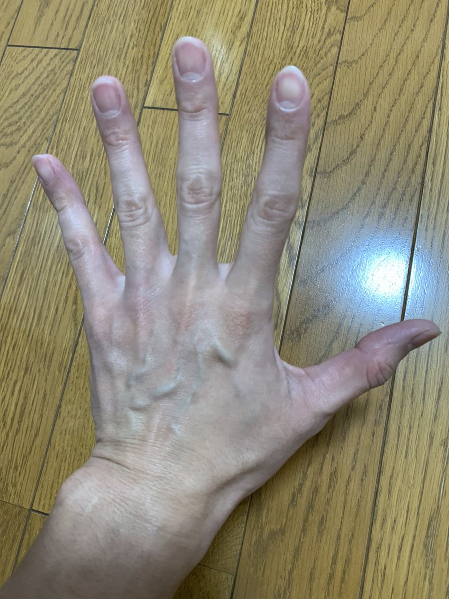 Show Ji Max 手の甲って 絶対整形出来ないし 1番年齢がわかるんですよ 代の手の甲って言われました ありがとうございます 手の甲 手 健康 美容 若返り 食 本物は永遠 エイジング 美容液 Show Ji Max 手の甲って 絶対整形出来ないし 1番年齢がわかるんですよ 代の手の甲って言われました ありがとうございます 手の甲 手 健康 美容 若返り 食 本物は永遠 エイジング 美容液