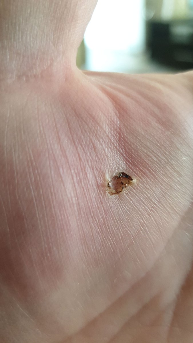 Folks please be careful with electricity. Almost got electricuted this morning. Was going to mow the lawn and didnt see a loose wire on the extension. Touched it and was shocked for 10 secs straight. It was flippen scary...was helpless /2