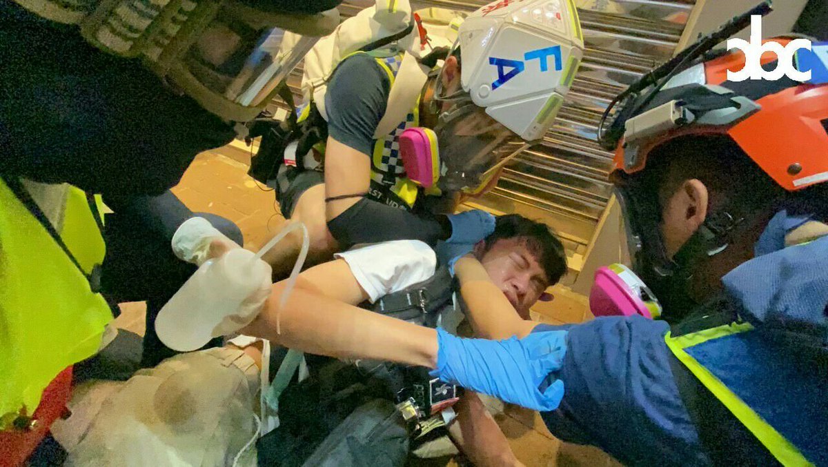 alphacentauriii's tweet photo. This 1st year Uni student was a volunteer first aid during the protest. He got hit by a Chinese Tear Gas canister in his back at Causeway Bay, 11/2. There were sparks at his back after he was shot. The wound was serious and the scar is horrible. #HongKong #HongKongPoliceBrutality https://t.co/UmILmTF4w8