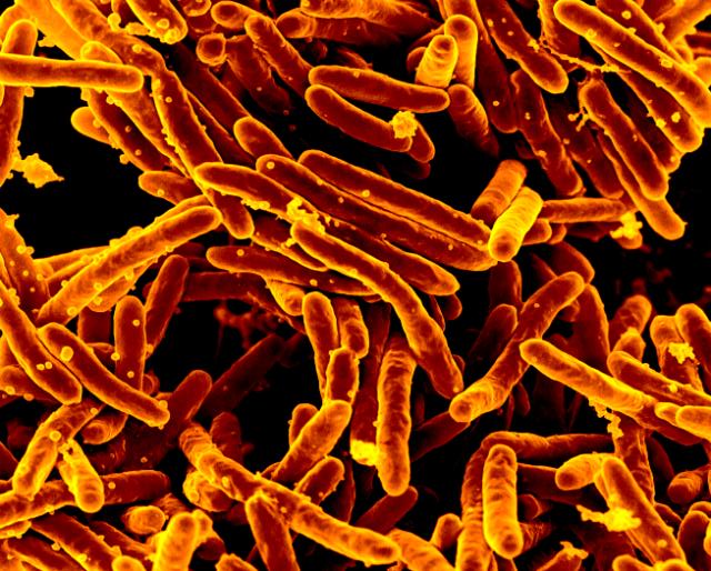 In our 6th most-read story this year, HHMI Professor <a href="/GHatfull/">Graham Hatfull</a>’s team <a href="/PittTweet/">University of Pittsburgh</a> demonstrated the first safe and effective use of engineered bacteriophages in a human patient: bit.ly/2Q5EXfp  #HHMI2019