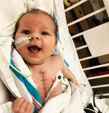 açık kalp ameliyatlı bebiş....
hayatındaki güzellikleri görmeyip her şeyden mutsuz olanlara bu gülümseme yeter :)