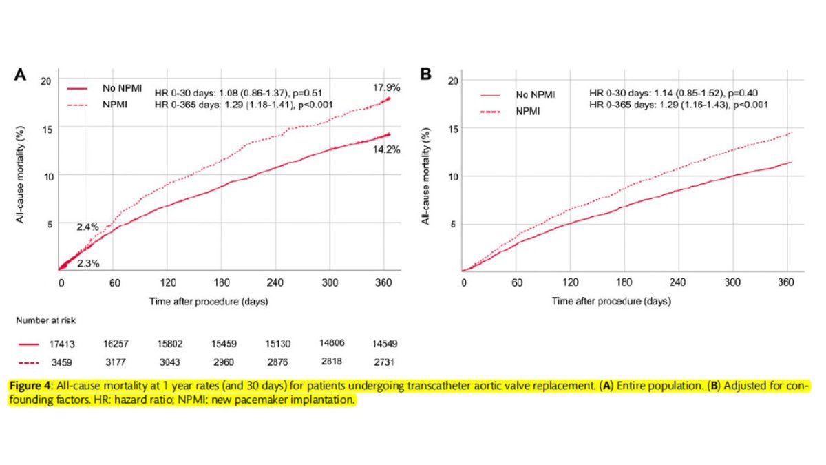 Mundo Real: GARY Registry: 28072 TAVR/17750 RVA. Implante Nuevo Marcapaso: TAVR:16.6% RVA: 3.6%. 
A 1 Año: Post ajuste con factores de confusión:TAVR > mortalidad:HR: 1.29 (p < 0.001). Hoy 2020 es una limitante a resolver para expandir TAVR al bajo riesgo. bit.ly/2MnwcN0