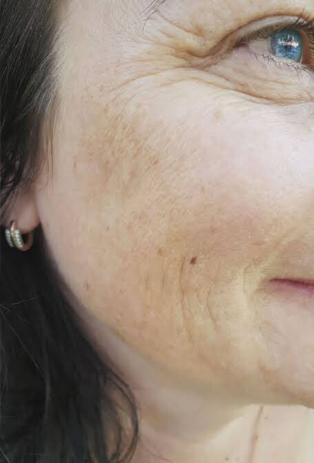 reticshop's tweet photo. Melasma treatment cream ? 

Grab the cream here: https://t.co/8OEokE218i

#melasma #reticaree #twitter #2wish #cream https://t.co/IUSxcR3YlH