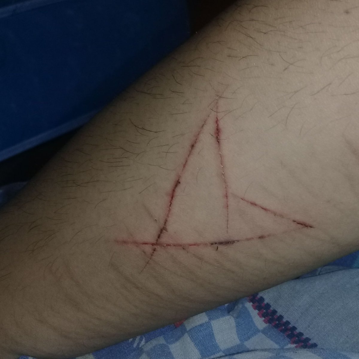 tinxstesia's tweet photo. I love when you make me bleed.
#selfharm #selfharmfetish #cuts #scars #scarfetish #blood #darkslut https://t.co/9fXz9o541A