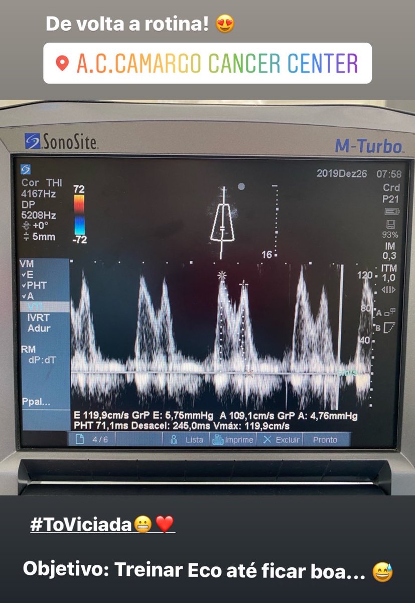 KrugerPri's tweet photo. De volta a rotina 😍 #ACC #UTI #ECO #POCUS #AvaliaçãoDiastólica #cardiotwitter #Cardiology #ICU #CriticalCare #VidaDeResidente #medicinaIntensiva https://t.co/YJNXsbqfTG