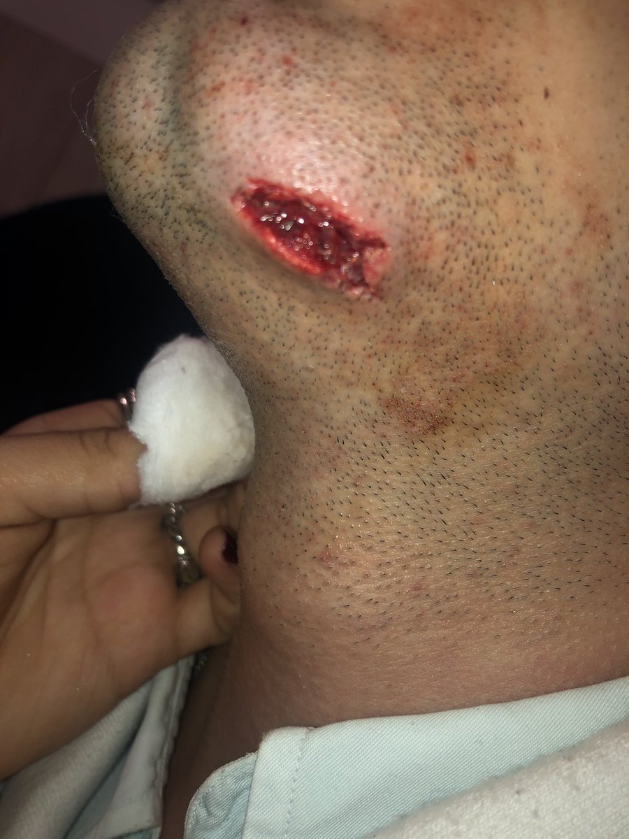 mafaldapcf2's tweet photo. Este é o Carvalho do azar,rt ou acontece vos o mesmo https://t.co/ufJp2hKvZd