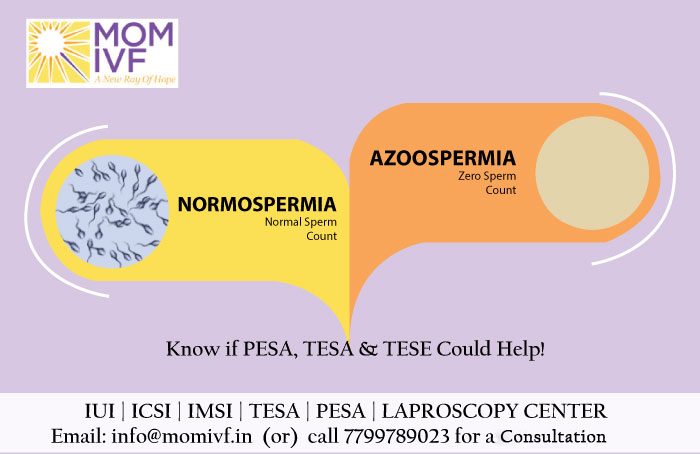 MomIvf's tweet photo. AZOOSPERMIA (ZERO SPERM COUNT)???
.
.
Book An Appointment / Consult our Doctors today!
#azoospermia #zerosperm #nosperm #sperm #maleinfertility #infertility #fertility #fatherhood #parenthood #father #maleinability #TESA #PESA #IVF #momivf #drpoornima #drpoornimadurga https://t.co/zZzBgeIRnl