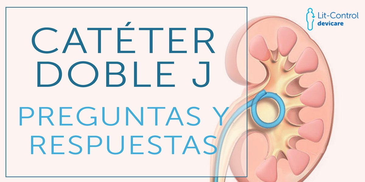 LitControl's tweet photo. ¿Qué conoces sobre el catéter doble J? Resuelve todas tus dudas en https://t.co/SYJtk4025m #LitControl #SaludUrinaria #CateterDobleJ https://t.co/RFuTMRnwtP