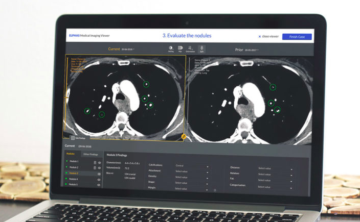 Meer tijd voor patiënten en minder tijd voor leren, maar wel met hetzelfde resultaat. Dat kan dankzij onze software! Om artsen sneller te trainen, hebben we een trainingsomgeving ontwikkeld waardoor artsen op hun eigen tempo en niveau kunnen leren. #ai elphas.ai/cases/