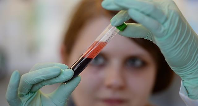 Dt_Aerzteblatt's tweet image. Deep-Learning-Algorithmen klassifizieren Leukämie-Blutproben auf Experten-Niveau:  München – Deep-Learning-Algorithmen können bei der Klassifizierung von Blutproben von Patienten mit akuter myeloischer… dlvr.it/RM1cP5 #NatureMachineIntelligence #Leukaemie #KI