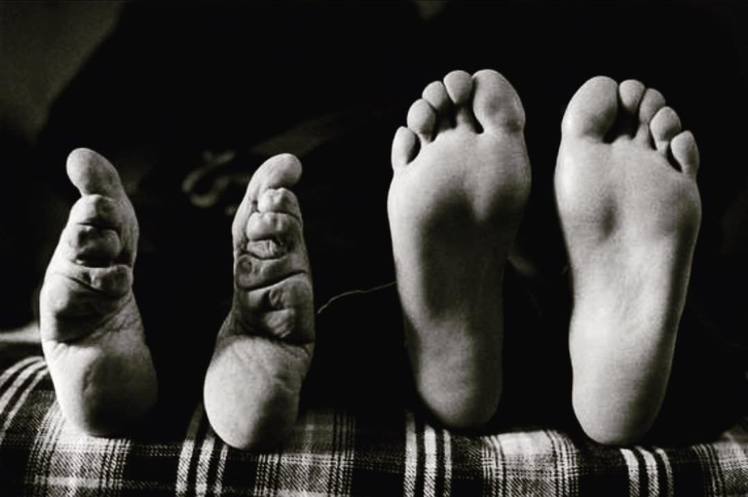 Yumi ゆみ 纏足 てんそく 幼児期より足に布を巻かせ 足が大きくならないようにする という かつて中国で女性に対して行われていた風習をいう より具体的には 足の親指以外の指を足の裏側へ折り曲げ 布で強く縛ることで足の整形 変形 を行うこと