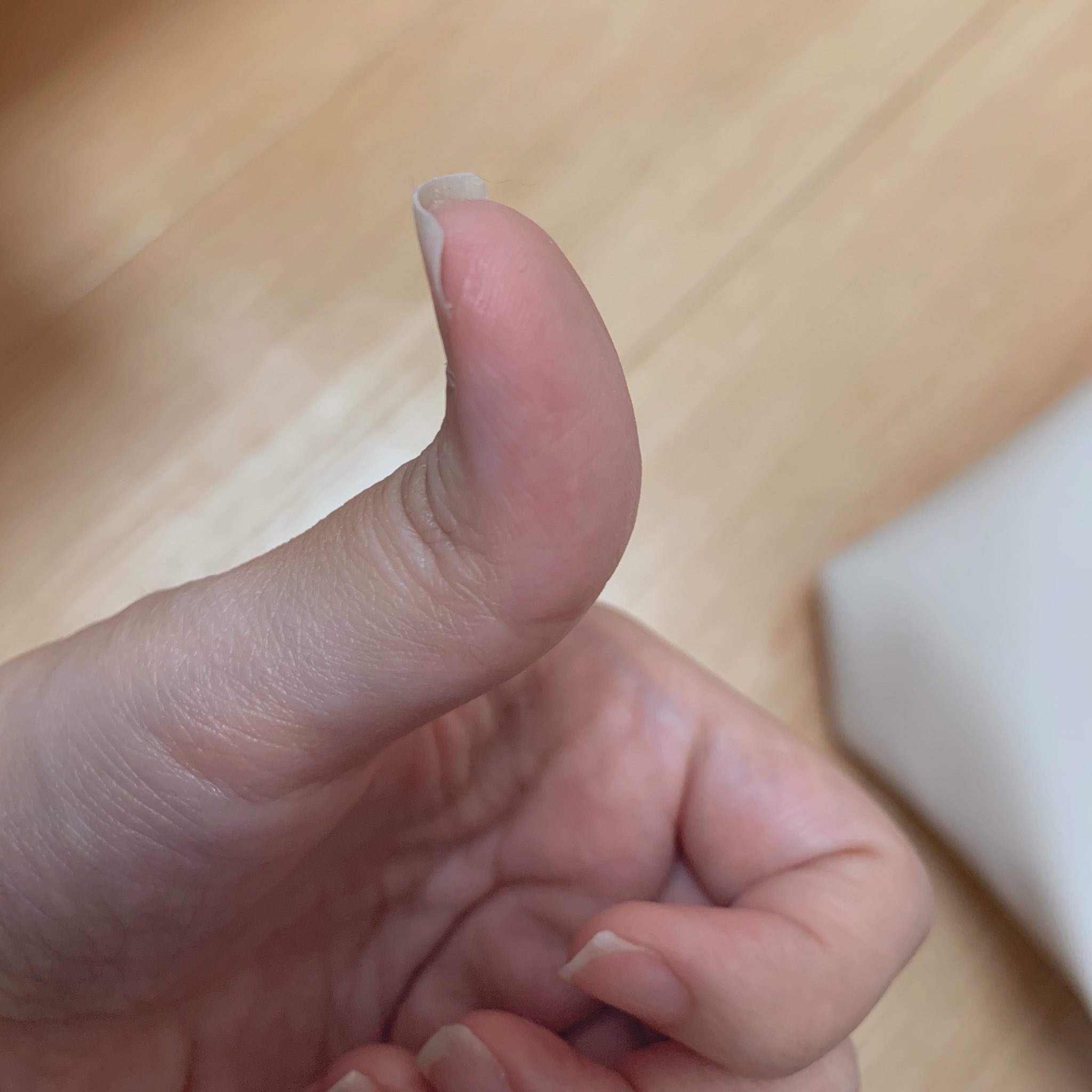Racco Ar Twitter 卵殻爪 栄養不足 爪が巻くねん 元々 巻き爪 ぎみでもあるけど キモイなー Racco Ar Twitter 卵殻爪 栄養不足 爪が巻くねん 元々 巻き爪 ぎみでもあるけど キモイなー