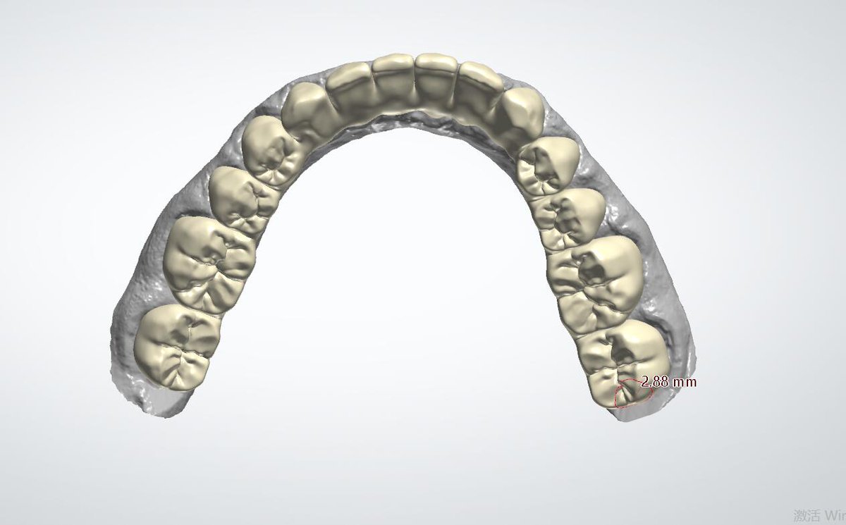 Ian Dental Design Studio, if you need to outsource design dental crowns, veneers, models, implants.
contact me .WeChat：+8618318409059/email：18318409059@163.com/WhatsAPP:+8618318409059