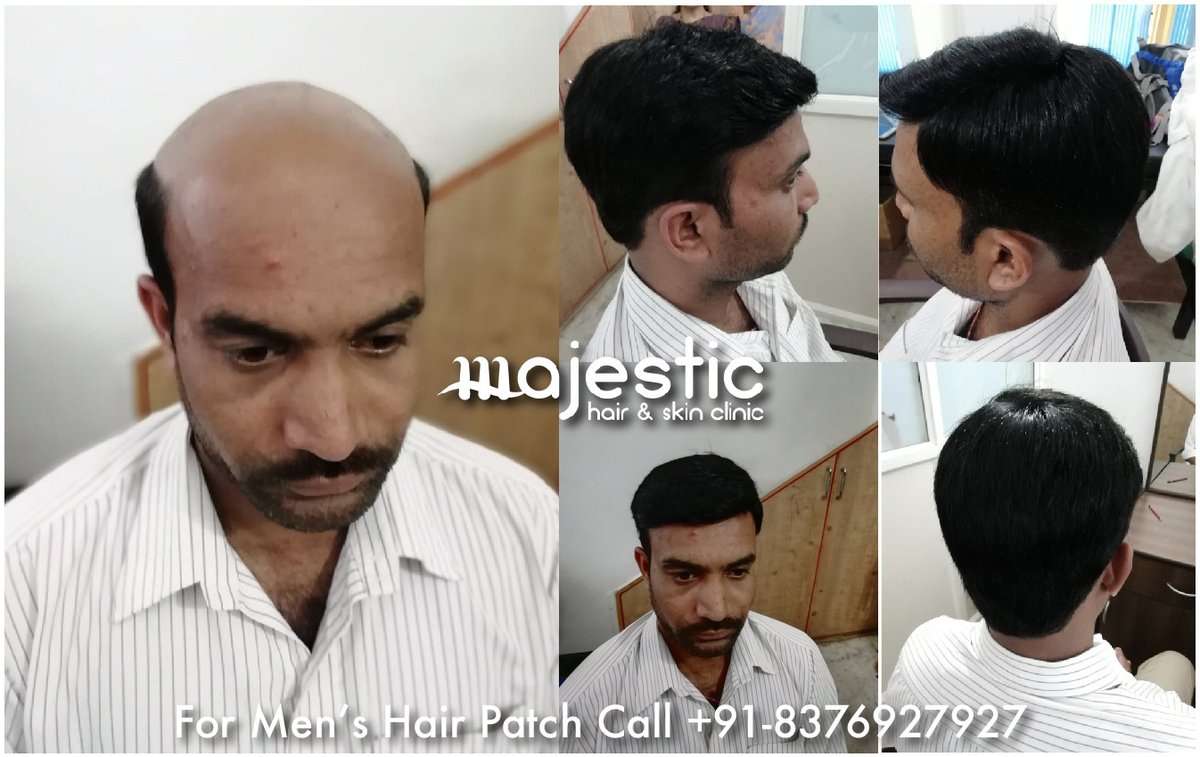 Majestic Hair Skin Clinic Majesticderma Twitter