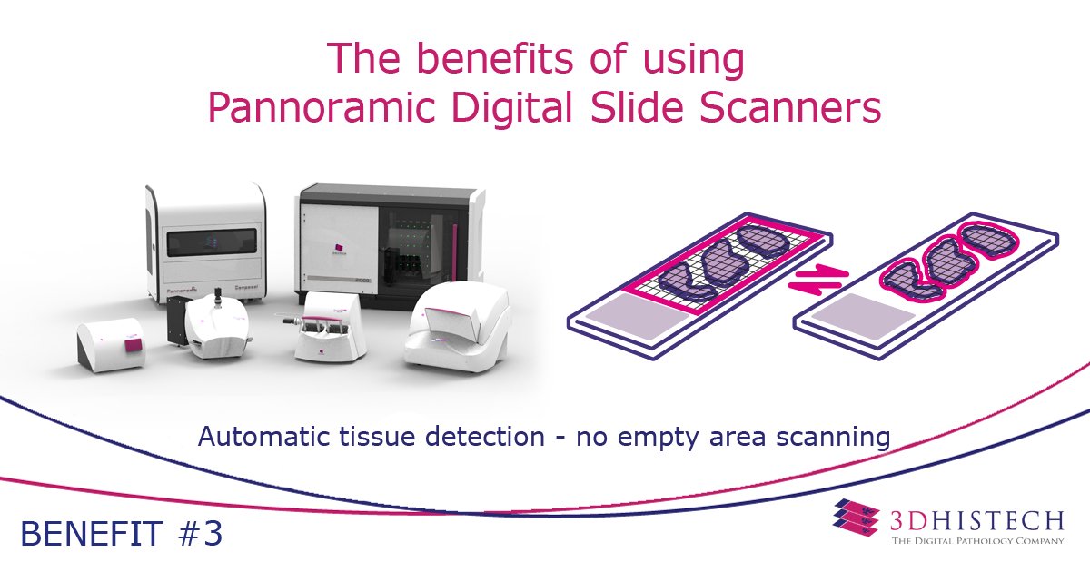 3DHISTECH_LTD's tweet photo. Why use #Pannoramic digital slide scanners from #3DHISTECH? With automatic tissue detection, we ensure that only the tissue will be scanned, thus saving storage space and scanning time for you.
To learn more about the benefits visit https://t.co/aju5zliCF0
#digitalpathology https://t.co/2wKzWEZwzo