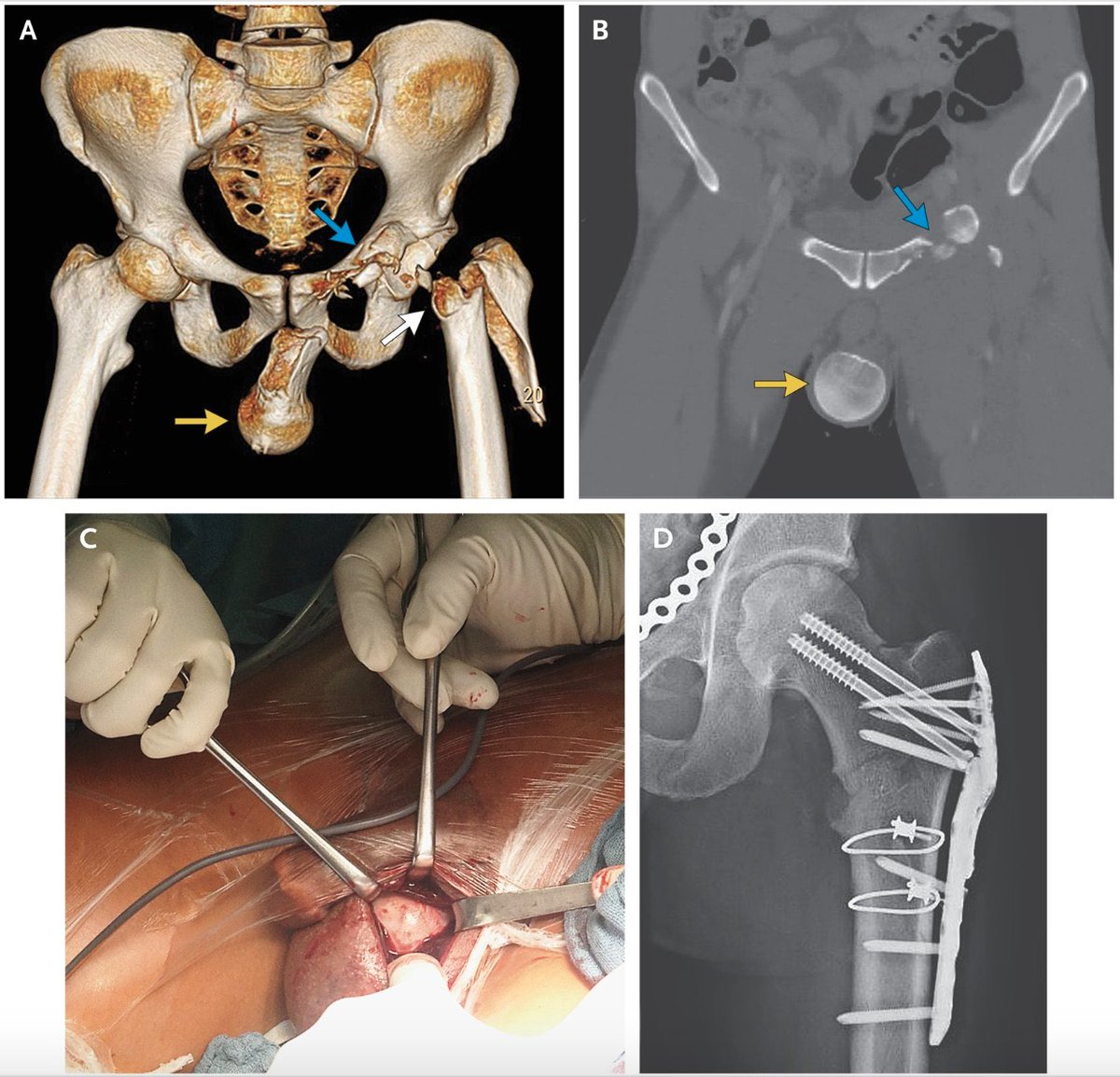 Sometimes life is really really hard. 

Sometimes you need reminding...

...things can always be worse. 

This is my “things can always be worse” reminder

#orthotwitter #medtwitter