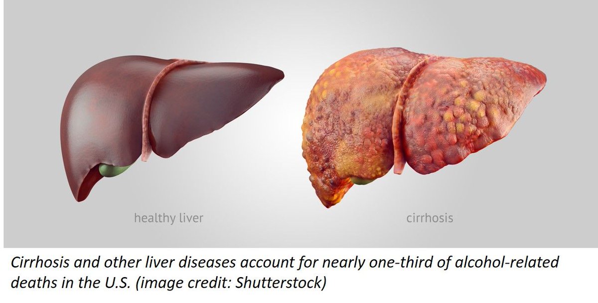 DoctorTanMD's tweet photo. U.S. Alcohol-Related Deaths Have Doubled - only cigarettes are deadlier than alcohol; Study Says https://t.co/KNYX74oVWM @vanromo @AubreyNPRFood 
Release from @NIDAnews: https://t.co/88wUHjILGp
#HealthyLongevity @timeuse @KateWGillespie @LizzzBethCarter @livi_dean https://t.co/h7DopwA6ZX