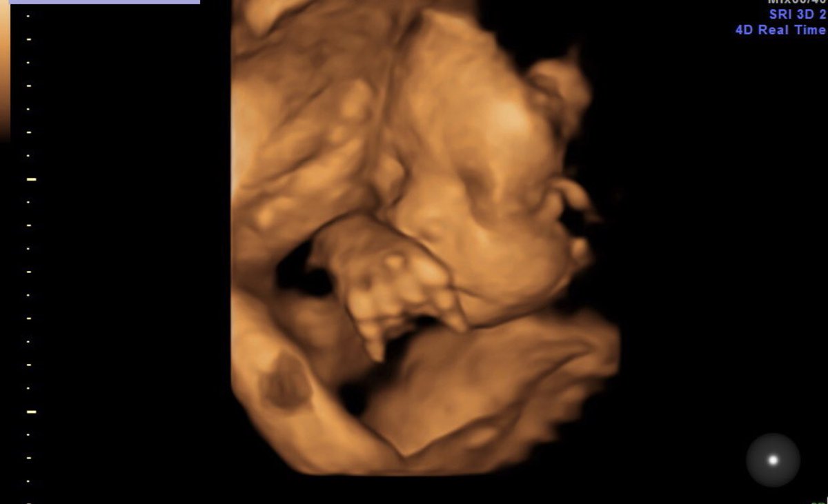 Heyyyyy mommy baby 😍🖤