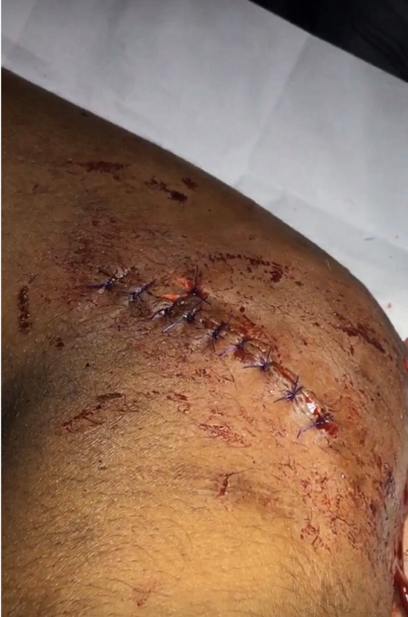 ausdrey_hp's tweet photo. Hoy es mi último turno en la ESE condoto  y tengo muchos sentimientos encontrados..... 🥺😭🙃😀💪🏽🙏🏽👩🏽‍⚕️, ame este proceso, amo todo lo que hago !! #medicine #vamos_por_mas https://t.co/WZ08LThlmt