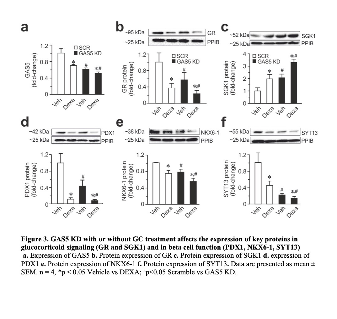 MolMetab's tweet photo. #glucocorticoid induces human #betacell dysfunction and involves the #riborepressor #GAS5 #lincRNA
#pancreas #Islet #T2D #diabetes
https://t.co/XcHVg5EaIJ https://t.co/qRKHqZUe3f