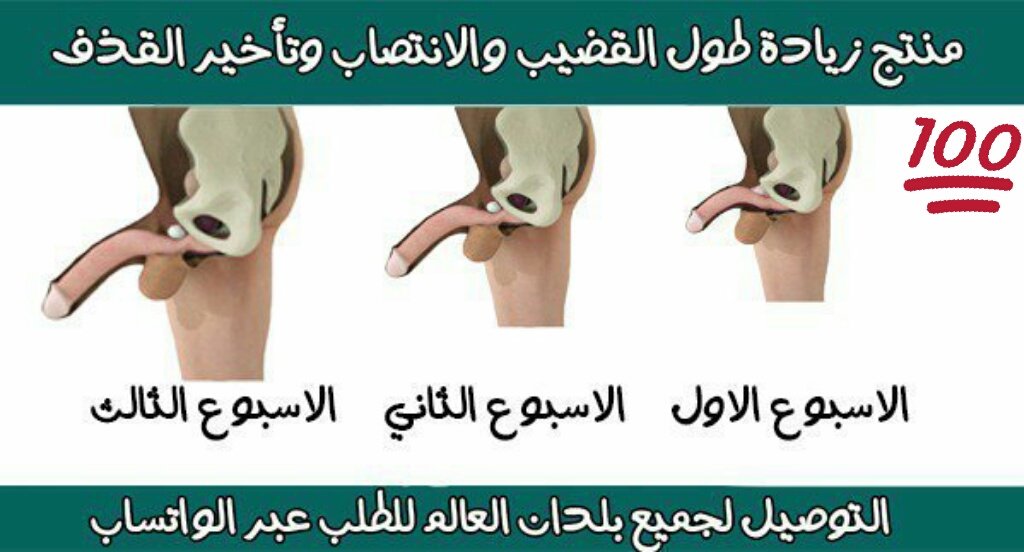 txiiiddj's tweet photo. الان    وجدنا لكم الحل 

    للتخلص  من 

@سًٍَِْر~عةًٍَِْ لًًٍَقذفًًٍَِْ   @ و ضًٍَِْعًٍَِْفًٍَِْ الانتًًٍََِْصًَِْاًٍَِْبًٍَِْ @ قصر القضيب

فقط  راسلني واتس الرابط في اول تعليق

#معين_عبدالٌٌٌٌٌٌملك_يخون_الشرعيهَََََِِِِِِِِِِِِِِ
#قررت_اصير_مشهور_Meَََََََََََِِِِِِِِِ https://t.co/aTgvclbLIM
