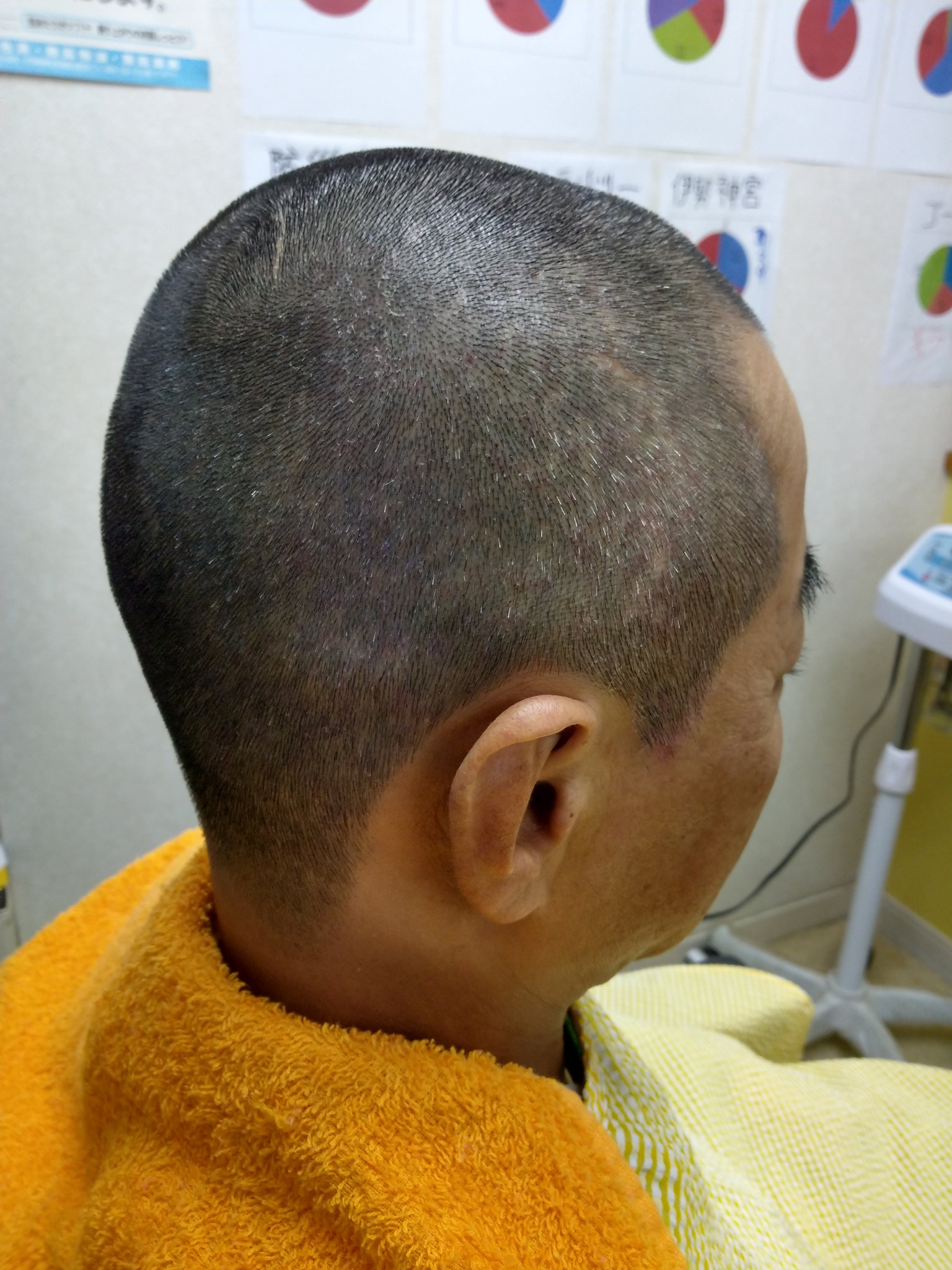 チェンジヘアサロン 丸刈り 5厘刈りは当サロンでは2ミリです 丸刈り 5厘刈り T Co Bv0q49kmrb Twitter チェンジヘアサロン 丸刈り 5厘刈りは当サロンでは2ミリです 丸刈り 5厘刈り T Co Bv0q49kmrb Twitter