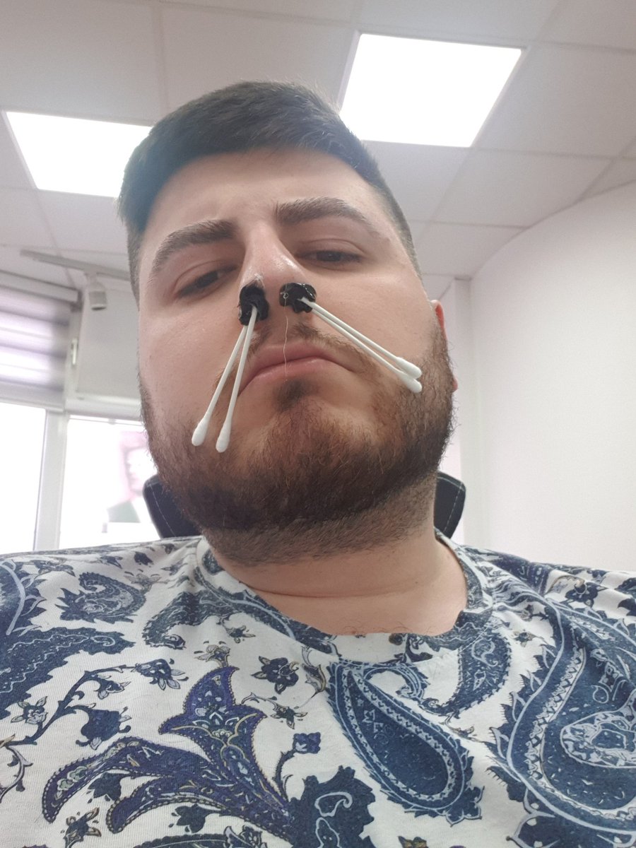 "zieh' mal die RP-Szene aus meiner Nase" 👁