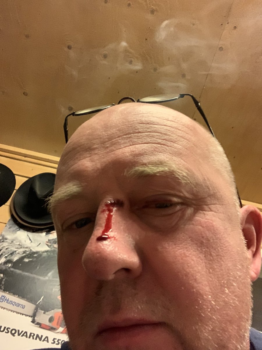 topchefstefan's tweet image. #doorspring #domesticviolence in my own house by my own door #timetochange old out new in