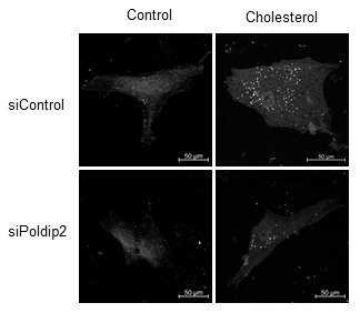 CircRes's tweet photo. #Poldip2 deficiency upregulates the #hexosamine biosynthetic pathway and O-GlcNAcylation, and induces highly differentiated phenotype of #VSMCs.
https://t.co/bLnOExFrol https://t.co/o84JX3DK5X