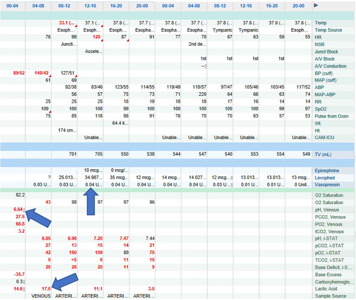 metformin-induced lactic acidosis with pH 6.54.  developed refractory vasoplegic shock (minimally responsive to catecholamine pressors &amp; vasopressin), but did respond to methylene blue bolus &amp; infusion... and survived!  (more on MILA here: emcrit.org/ibcc/metformin/)