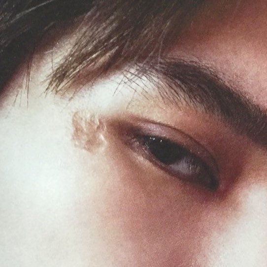 i love taeyong and his scar