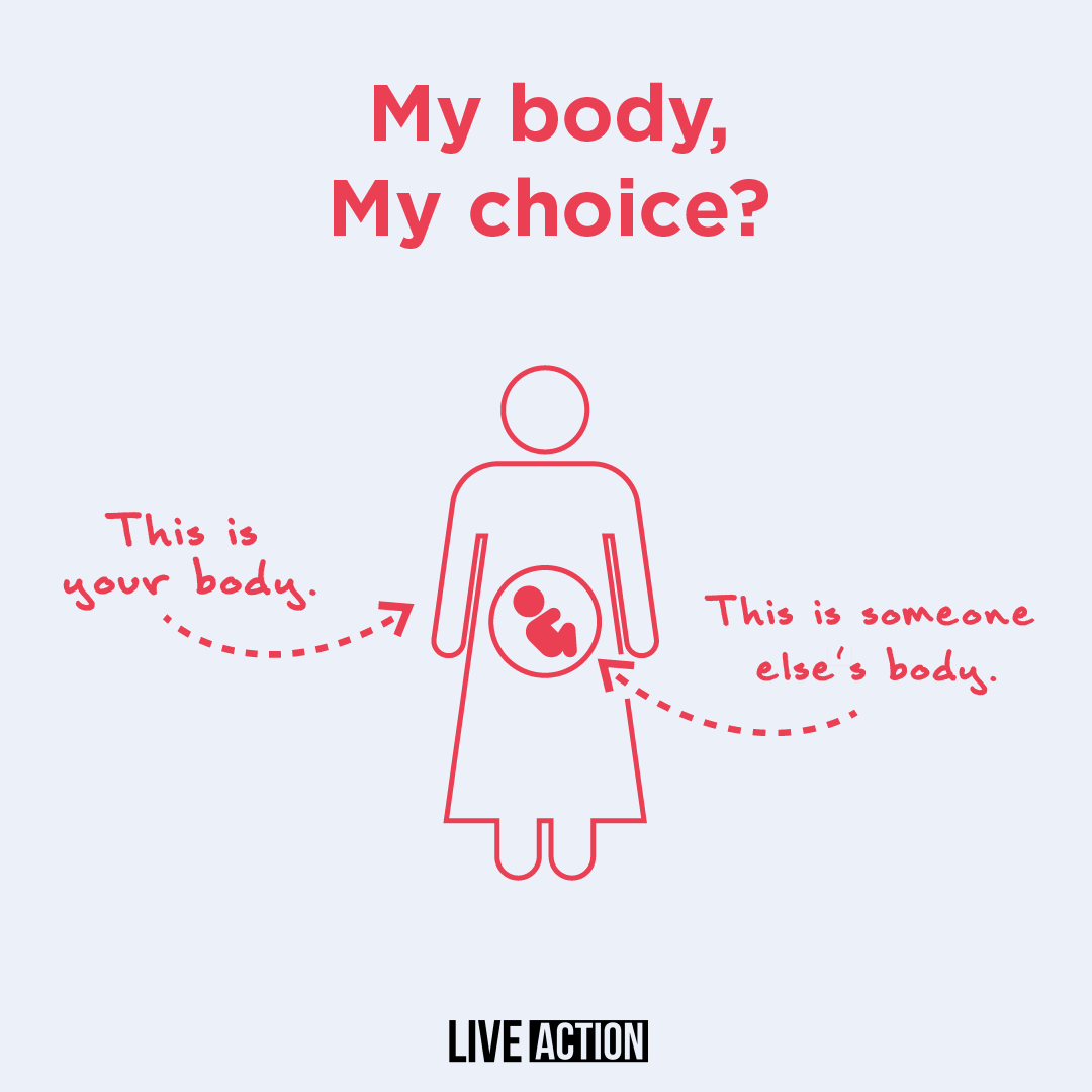 LiveAction's tweet photo. Every abortion kills a distinct human being. 

RT to share these common sense facts! https://t.co/S74vPbn9JD
