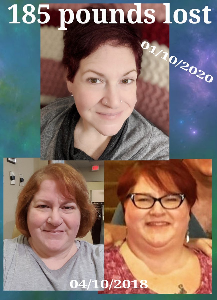 Only 49lbs to go! #facetofacefriday #weighlossmotivation #weightlossjourney #weightlosstransformation  #weightloss #fitness #healthylifestyle #health #bariatriclife #bariatric #wls #duodenalswitch #dssurgery