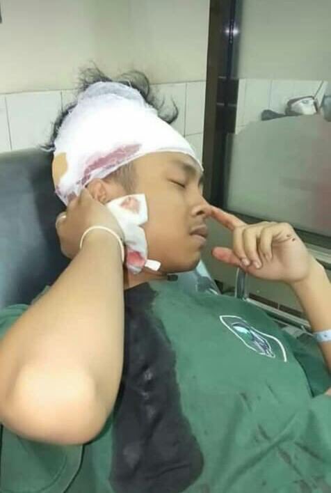 Dapet kabar anak kelas 10 dibegal, videonya saya share besok setelah perwakilan PRB menjenguk ke rumah sakit