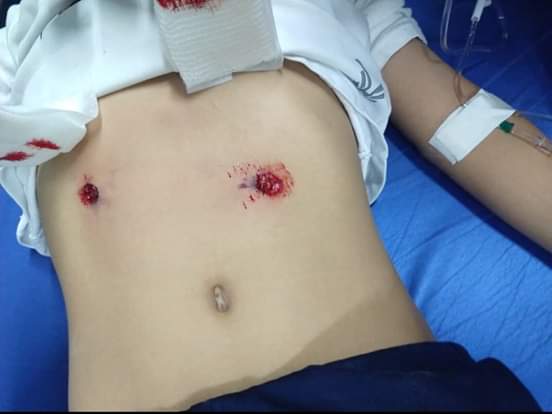 MarryTorre30's tweet photo. #ALMOMENTO Confirman dos muertos y 4 alumnos heridos de bala dentro de #ColegioCervantesdelBosque, en la ciudad de #Torreón, #Coahuila el nombre del alumno llamado #Jarid Al parecer menor de 12 años llevó arma a la escuela. https://t.co/a9N5V5dZAL