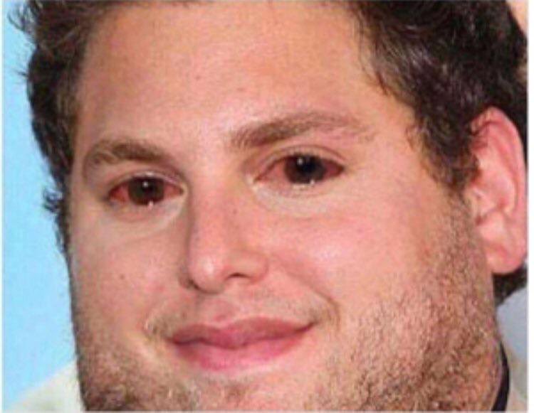 <a href="/SaudSleem/">د. سعود آل سليم</a> متى ما لعب الاتحاد لنفسه
سيعود"...!!
اليوم المونديالي لعب لغيره ..!!..
لن تنهض وأنت تلعب لغيرك .!!..