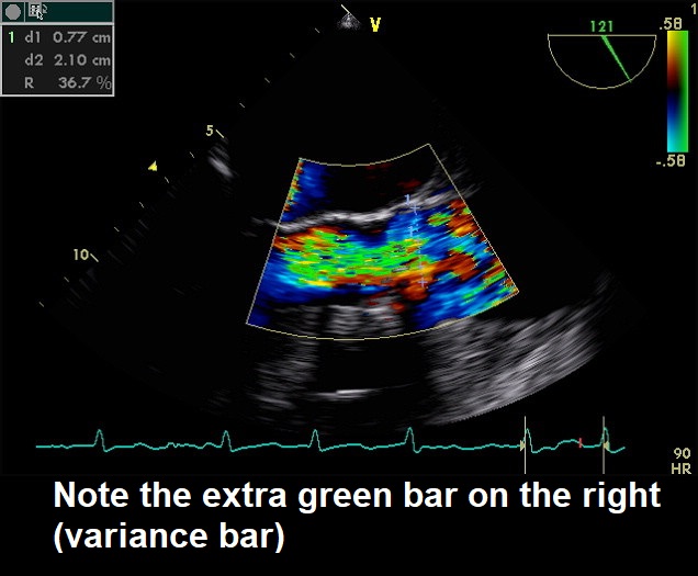 Aman Thind on Twitter: