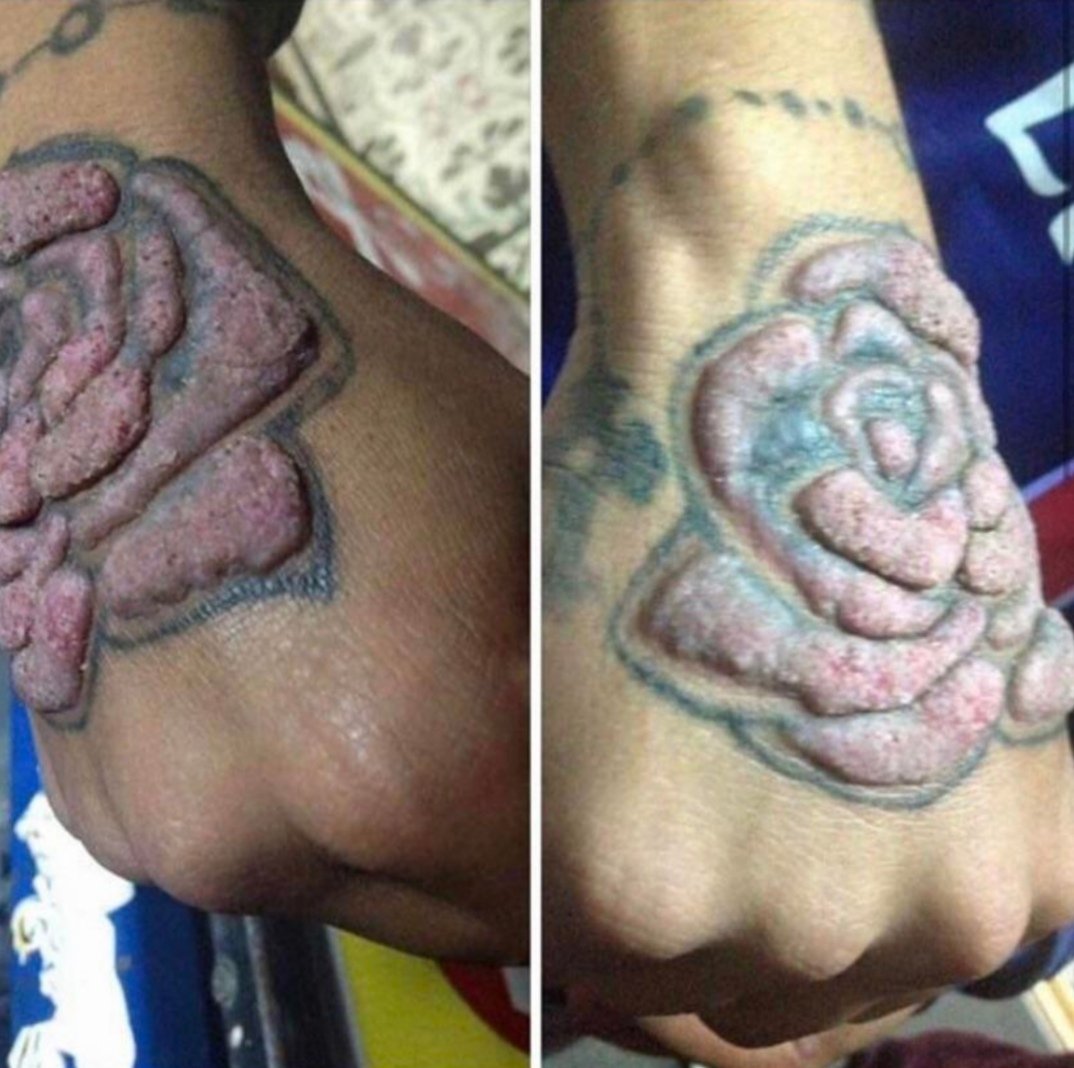 Thinking of getting a tattoo Pick the colours carefully Health Hindustan Times #34 Thinking of getting a tattoo Pick the colours carefully Health Hindustan Times