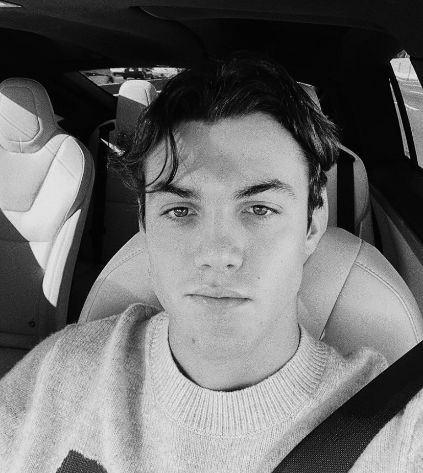 my upper lip feels naked