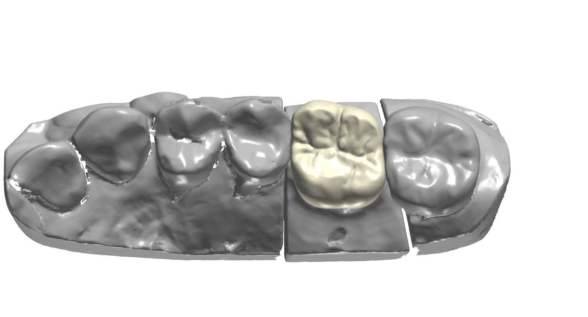Professional design, excellent service, affordable price from Ian Dental Design Lab
