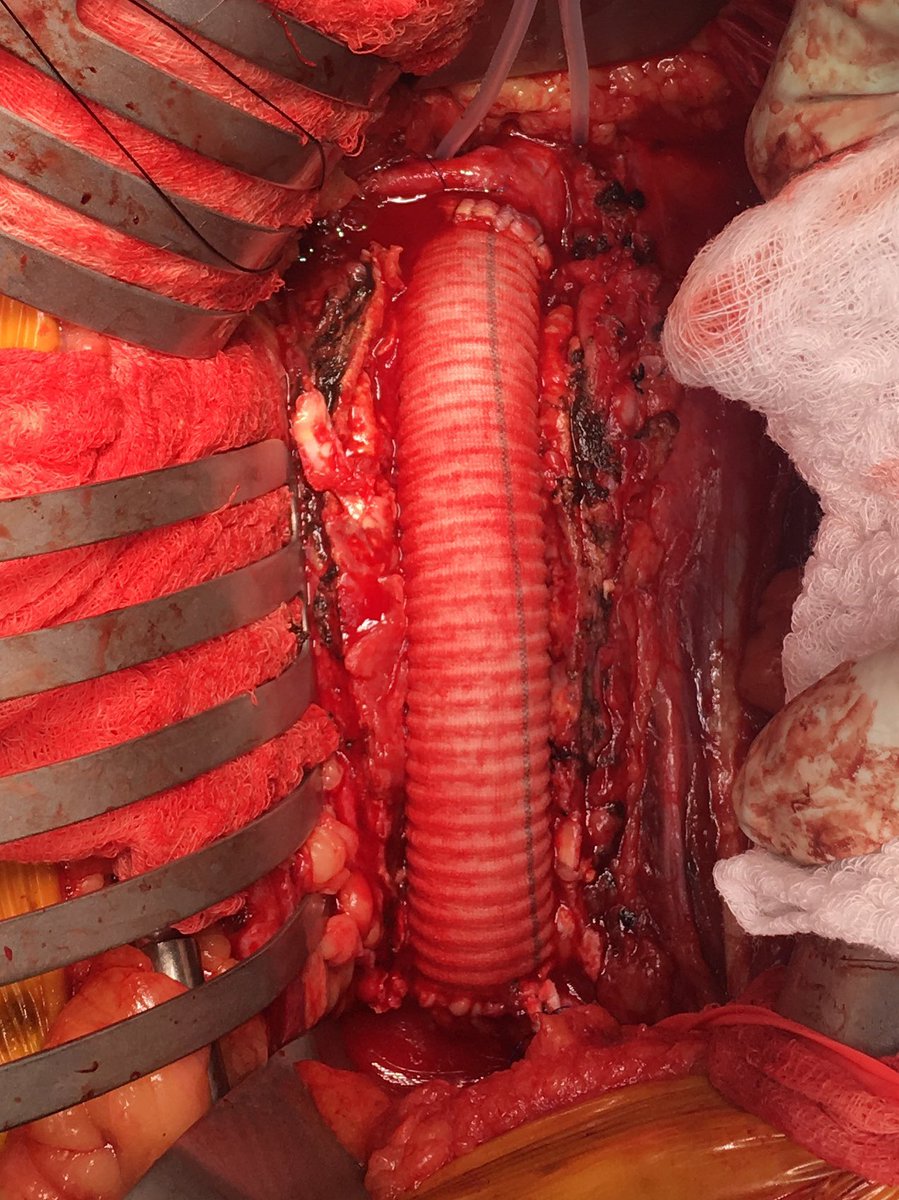 Eric Endean tweet media