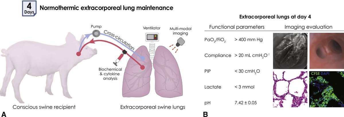 GVNlab's tweet photo. Our paper on extended (4 days) support of extracorporeal donor lungs is out now in the Journal of Thoracic and Cardiovascular Surgery @AATSJournals - check it out!! #lungbioengineering #crosscirculation https://t.co/FcPQ2A8yqi https://t.co/8dG8dzSJG0
