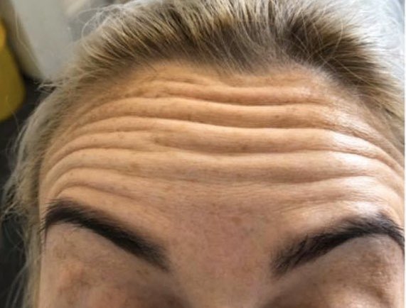 Surface_Beauty's tweet photo. Make your friends wonder how you look so good with botox treatment at our Edinburgh clinic.

Our practitioners are medically qualified, fully registered and only use 100% approved products

https://t.co/42mp5SFrOd

#lookyourbest #botox #edinburghbotoxclinic https://t.co/vzVxTMr4Eo