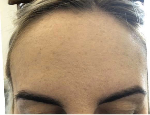 Surface_Beauty's tweet photo. Make your friends wonder how you look so good with botox treatment at our Edinburgh clinic.

Our practitioners are medically qualified, fully registered and only use 100% approved products

https://t.co/42mp5SFrOd

#lookyourbest #botox #edinburghbotoxclinic https://t.co/vzVxTMr4Eo