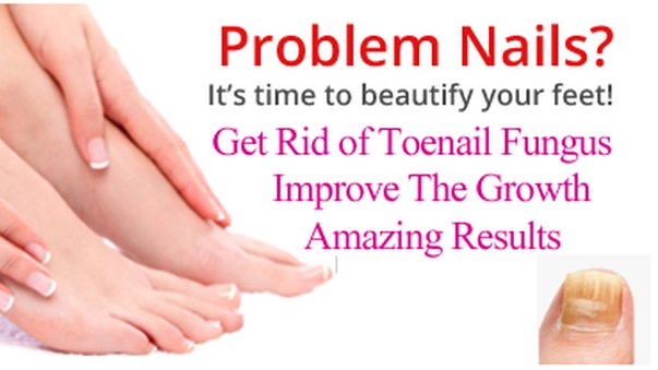 itsallabthealth's tweet photo. Get Rid of Nail Fungus in 2020, https://t.co/uiTbexN1E6 #2020WillBeTheYearFor #MondayMotivation #1YearWithPromise #mondaythoughts #NewYear #NewYear2020 #NewYearsEve #nailfungus #care #nails #nailart #HealthTips #beauty #beautytips #California #Florida #beautyblogger #WashingtonDC https://t.co/FLRAUXrVh0