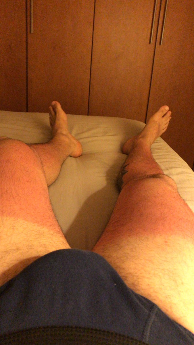 Uma volta  de bike na orla deu nisso