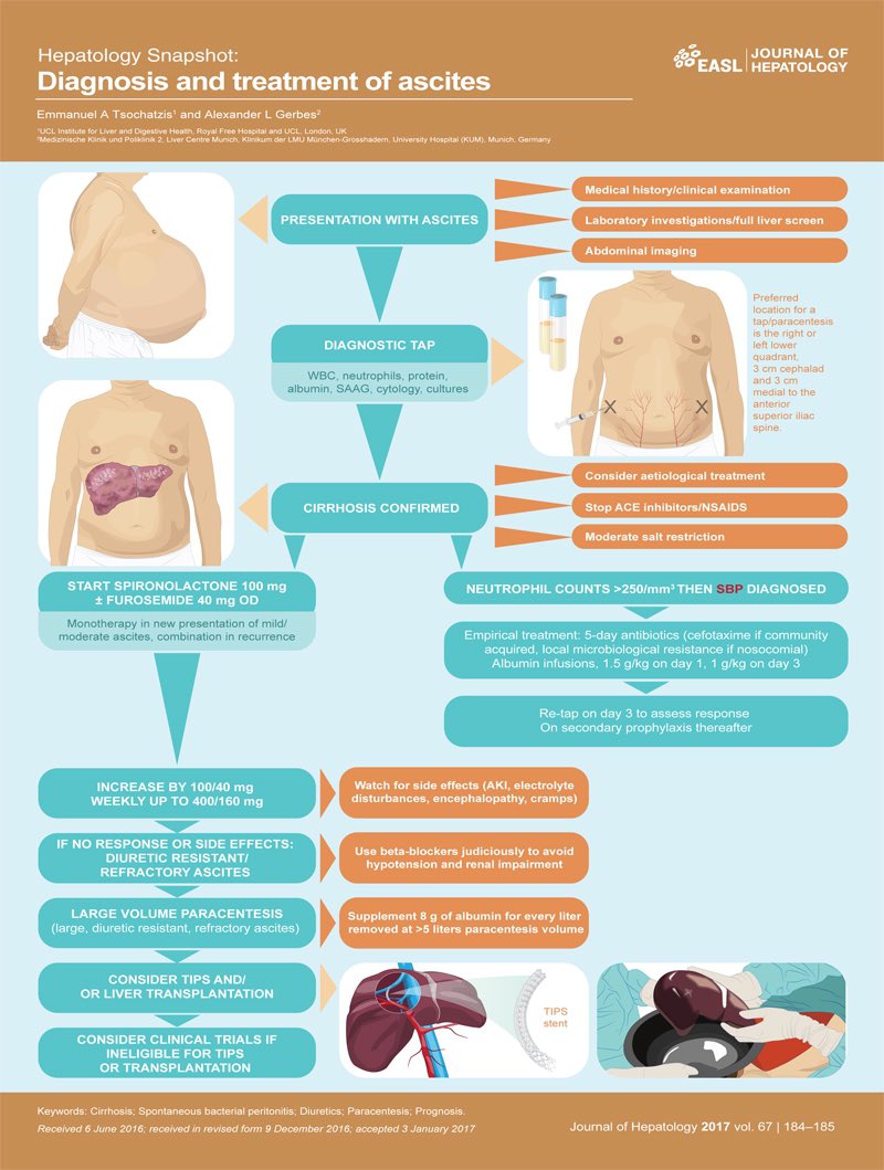DigestivoHuc's tweet photo. Diagnosis and treatment of ascitis https://t.co/e17GXVP76C
